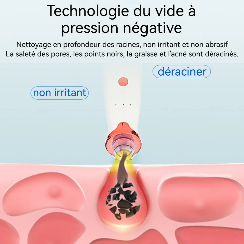 Aspirateur Point Noir 5V1A Ultra-léger Pression négative sous vide Longue durée vie de la batterie Aspirateur Point Noir é...