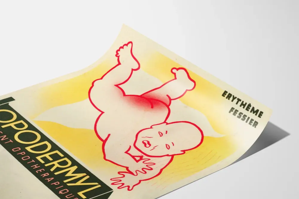 Affiche vintage Opodermyl contre l'érythème fessier