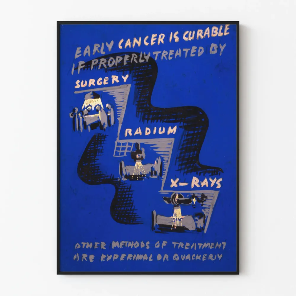 Affiche Vintage sur le Traitement Précoce du Cancer par Chirurgie et Radiothérapie