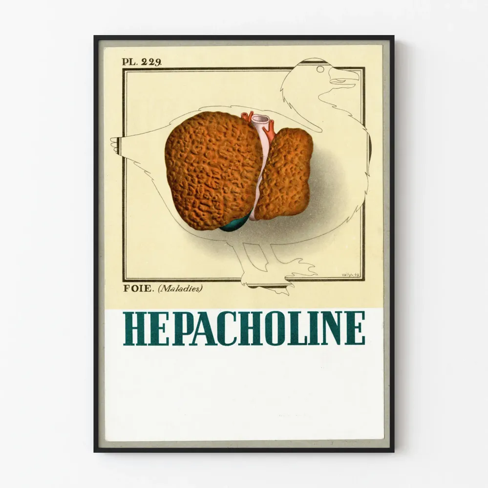 Affiche Vintage Médicale Illustration Foie Hépatique Artem Legrand